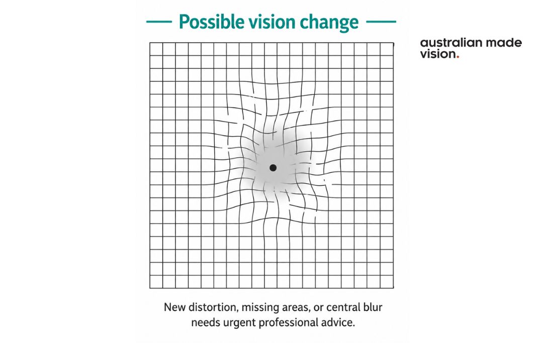 Amsler grid showing wavy lines, missing areas and central blur that may indicate a change in central vision